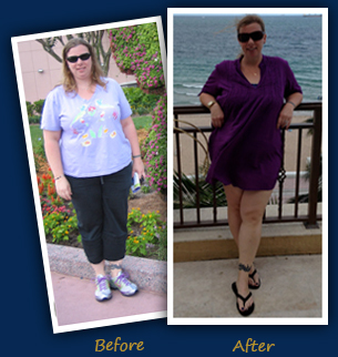 Jessica R. (Tamarac, FL)- Before and After