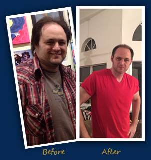 Jason (Boca Raton, FL) - Before and After