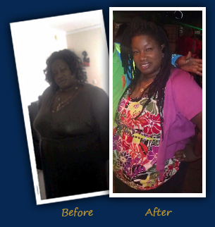 Joanne W., Coral Springs, FL- Before and After