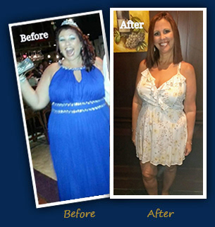 Laurie P. - Before and After