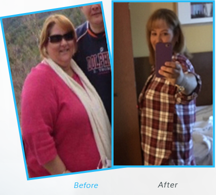 Success Stories or testimonials  of Dr.Shillingford about Gastric Sleeve Surgery 3