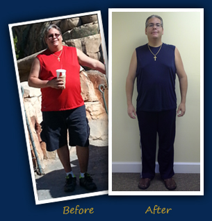 Bariatric Success Stories - Sterling Surgicare